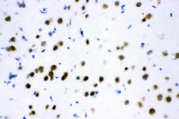 ATF2 Rabbit Polyclonal Antibody