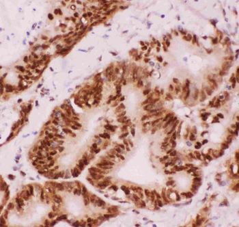 ATF2 Rabbit Polyclonal Antibody