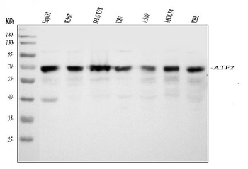 ATF2 Rabbit Polyclonal Antibody