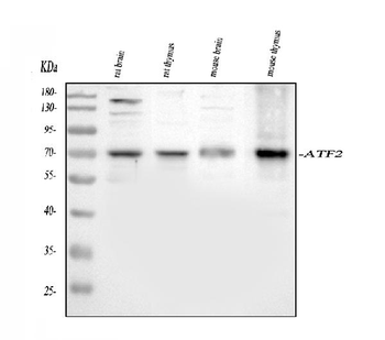 ATF2 Rabbit Polyclonal Antibody