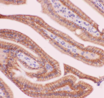 alpha 1 Catenin/CTNNA1 Antibody