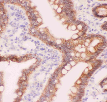 alpha 1 Catenin/CTNNA1 Antibody