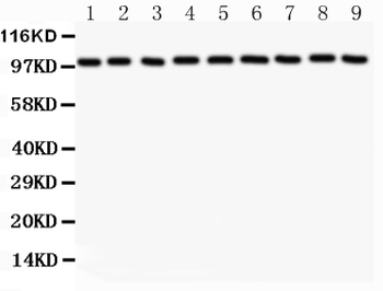 alpha 1 Catenin/CTNNA1 Antibody