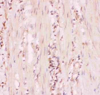 MRP4/ABCC4 Rabbit Polyclonal Antibody
