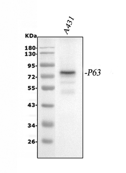 p63/TP63 Rabbit Polyclonal Antibody