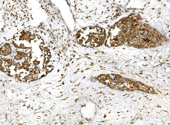 PROM1 Rabbit Polyclonal Antibody