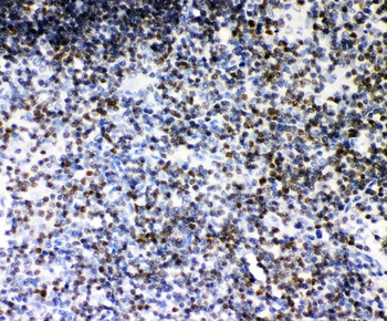 RUNX1/AML1 Rabbit Polyclonal Antibody