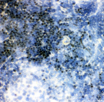 RUNX1/AML1 Rabbit Polyclonal Antibody