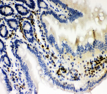 RUNX1/AML1 Rabbit Polyclonal Antibody