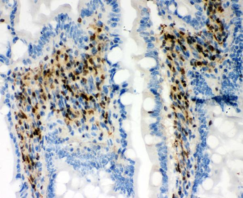 RUNX1/AML1 Rabbit Polyclonal Antibody