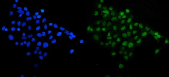 SIRT1 Rabbit Polyclonal Antibody