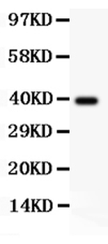 TdT/DNTT Antibody