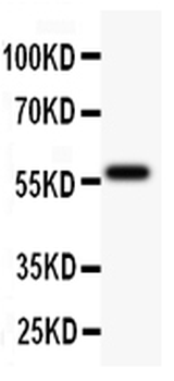 TdT/DNTT Antibody