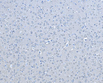 B Raf/BRAF Antibody
