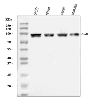 B Raf/BRAF Antibody