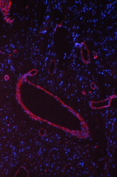 Caveolin-1/CAV1 Rabbit Polyclonal Antibody