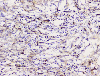 Caveolin-1/CAV1 Rabbit Polyclonal Antibody