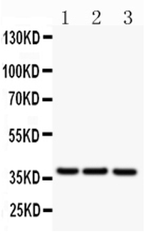 CD79b Antibody