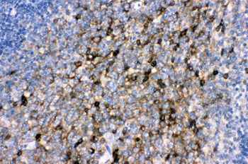 CD82 Rabbit Polyclonal Antibody