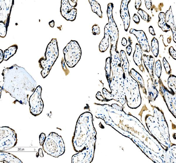 CEBP Beta/CEBPB Antibody