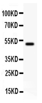 KAT3B/p300/EP300 Antibody