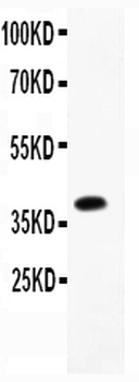 Furin Rabbit Polyclonal Antibody