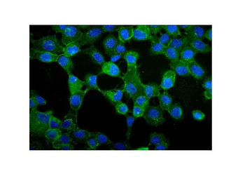 gamma Catenin/JUP Rabbit Polyclonal Antibody