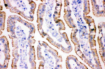 gamma Catenin/JUP Rabbit Polyclonal Antibody