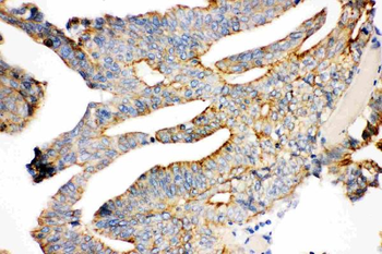 gamma Catenin/JUP Rabbit Polyclonal Antibody