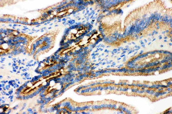 gamma Catenin/JUP Rabbit Polyclonal Antibody