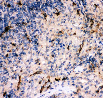 C5/C5a Rabbit Polyclonal Antibody