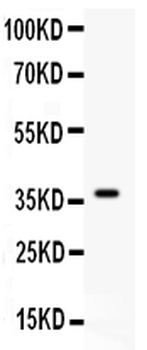 C5/C5a Rabbit Polyclonal Antibody