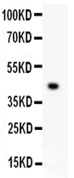 EDA Rabbit Polyclonal Antibody