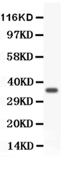 FOXM1 Rabbit Polyclonal Antibody