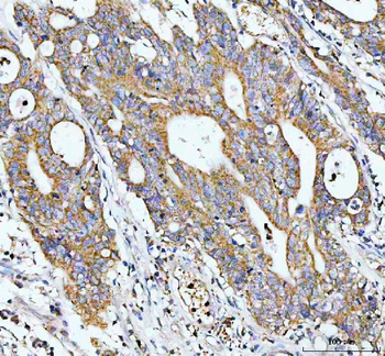 GCLC Rabbit Polyclonal Antibody