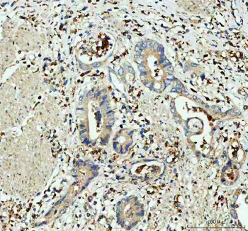 Glutathione Peroxidase 1/GPX1 Rabbit Polyclonal Antibody (Peroxidase)
