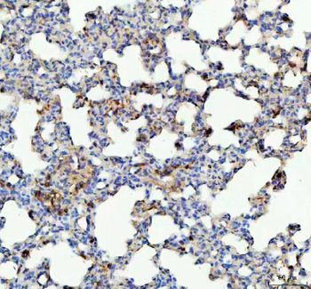 Glutathione Peroxidase 1/GPX1 Rabbit Polyclonal Antibody (Peroxidase)