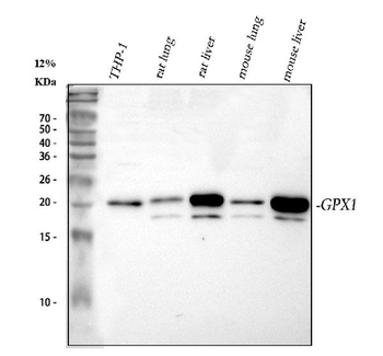 Glutathione Peroxidase 1/GPX1 Rabbit Polyclonal Antibody (Peroxidase)
