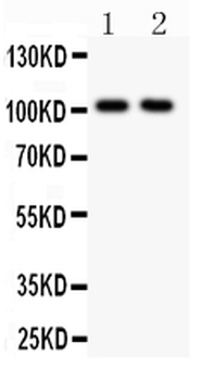 Glutamate Receptor 1/GRIA1 Rabbit Polyclonal Antibody