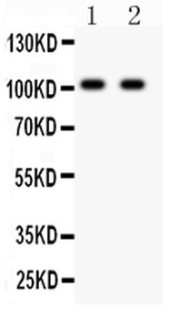 Ionotropic Glutamate receptor 4/GRIA4 Rabbit Polyclonal Antibody