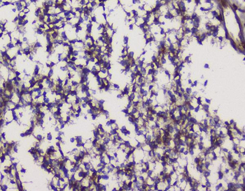GRIK1 Rabbit Polyclonal Antibody