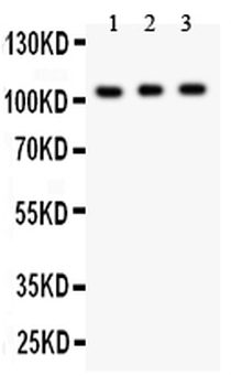 GRIK1 Rabbit Polyclonal Antibody