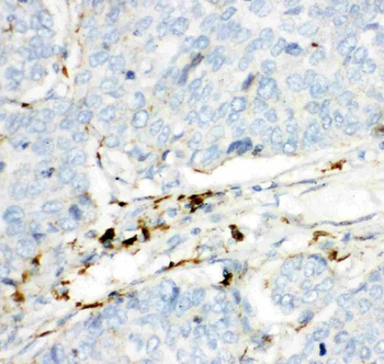 HEXB Rabbit Polyclonal Antibody