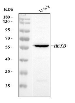HEXB Rabbit Polyclonal Antibody