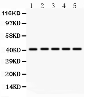 HOXA10 Rabbit Polyclonal Antibody