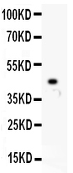 HOXA10 Rabbit Polyclonal Antibody