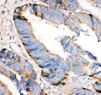 HRG Rabbit Polyclonal Antibody