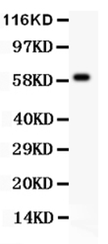HRG Rabbit Polyclonal Antibody