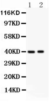 MUM1/IRF4 Rabbit Polyclonal Antibody