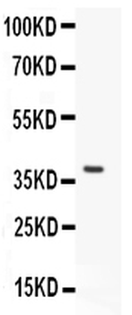 MUM1/IRF4 Rabbit Polyclonal Antibody